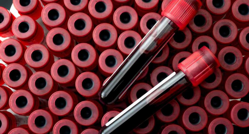 Understanding Blood Tests: What They Can Reveal About Your Health