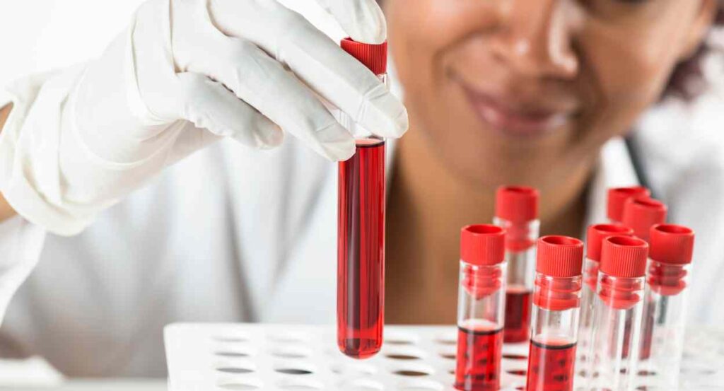 Understanding Blood Tests: What They Can Reveal About Your Health