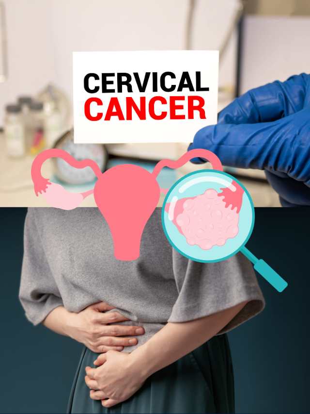 Cervical Cancer in India: Take these steps to protect yourself