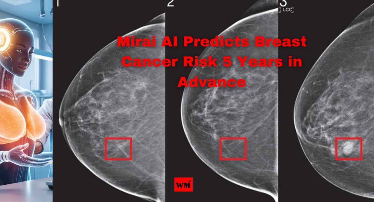 Mirai AI Predicts Breast Cancer Risk 5 Years in Advance