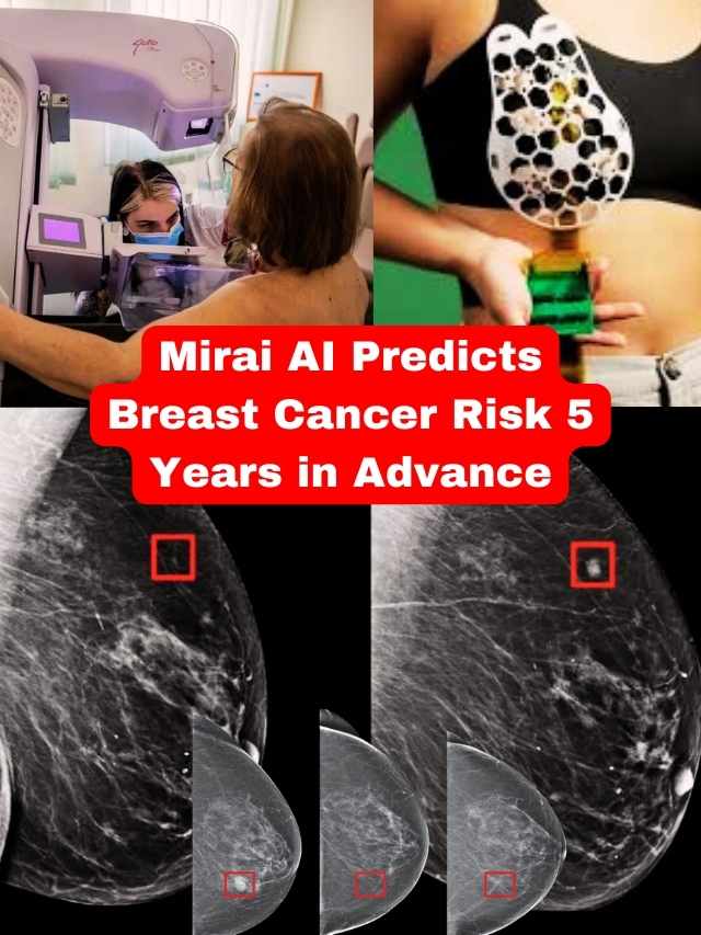 How Does Mirai AI Spot Breast Cancer 5 Years Early?